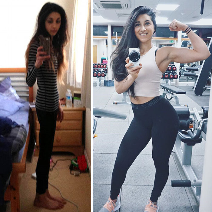 Фотография: До и после: 20 примеров людей, сумевших побороть анорексию №16 - BigPicture.ru