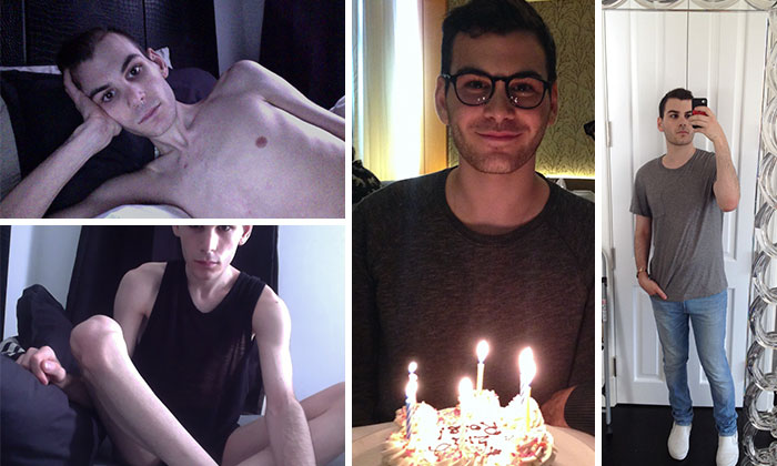 Фотография: До и после: 20 примеров людей, сумевших побороть анорексию №17 - BigPicture.ru