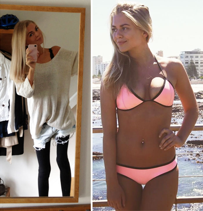 Фотография: До и после: 20 примеров людей, сумевших побороть анорексию №20 - BigPicture.ru