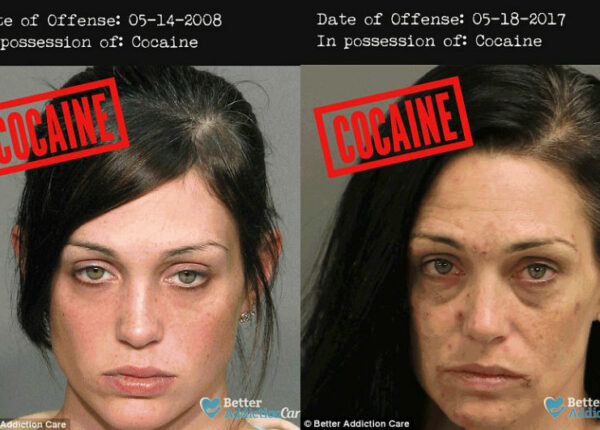 Лица наркозависимых до и после: как запрещенные вещества влияют на внешность