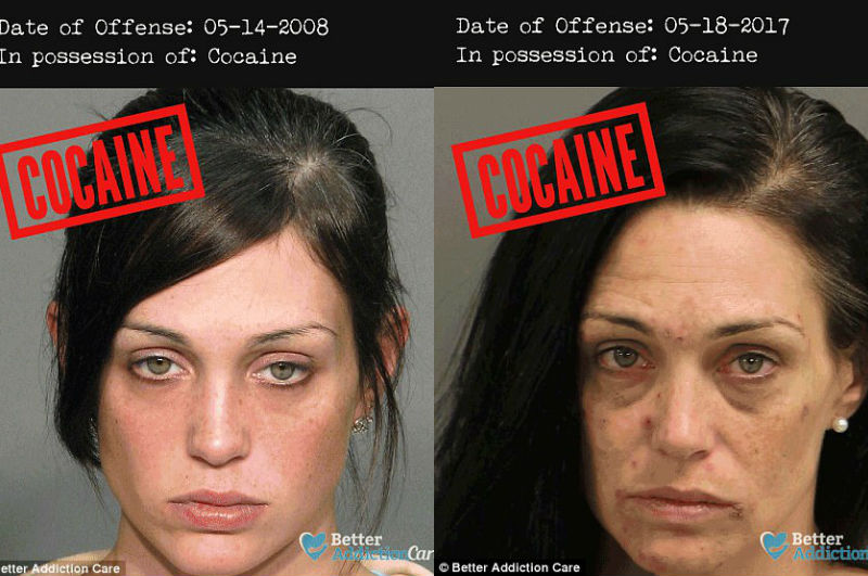 Наркотики до и после как скачать тор браузер с оф сайта hydra