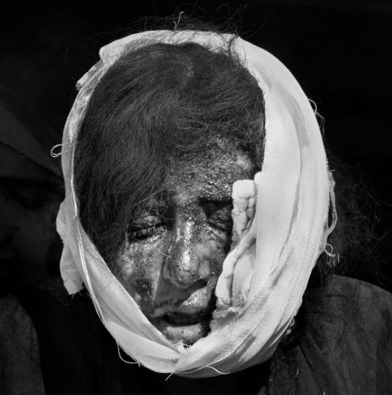 Фотография: Лица Мосула: взгляд фотографа на людей, пострадавших от борьбы армии Ирака против ИГИЛ №13 - BigPicture.ru