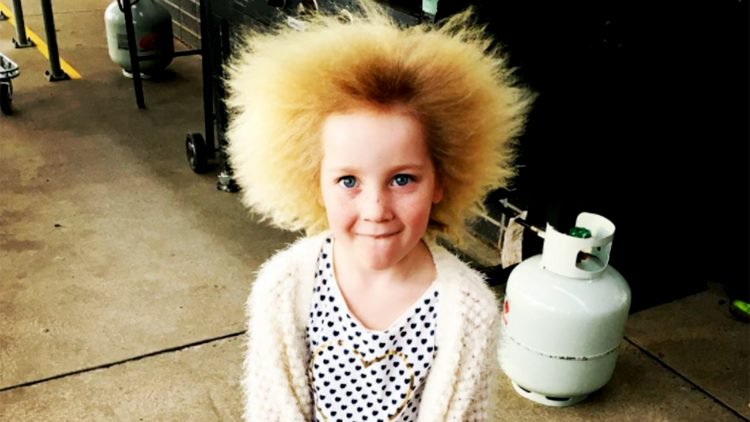 Фотография: Расчеши меня полностью! Из-за редкой генетической аномалии девочка не может справиться с волосами №1 - BigPicture.ru