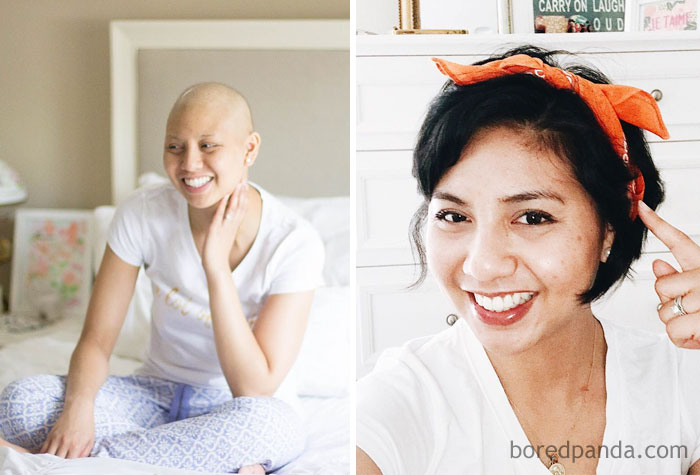Фотография: Люди, которые победили рак, в фотографиях 