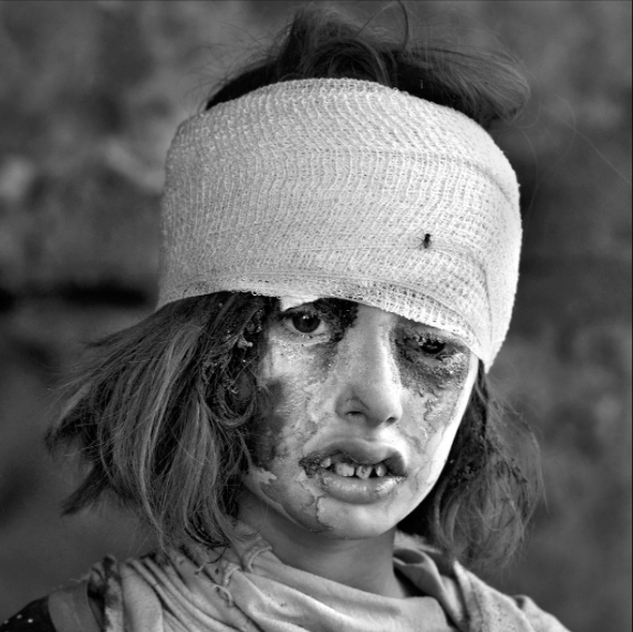 Фотография: Лица Мосула: взгляд фотографа на людей, пострадавших от борьбы армии Ирака против ИГИЛ №2 - BigPicture.ru