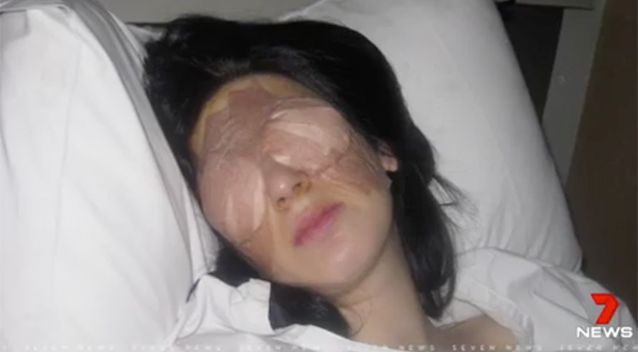 Фотография: Поднимите мне веки: женщина борется с необъяснимой болезнью закрывающихся глаз №5 - BigPicture.ru