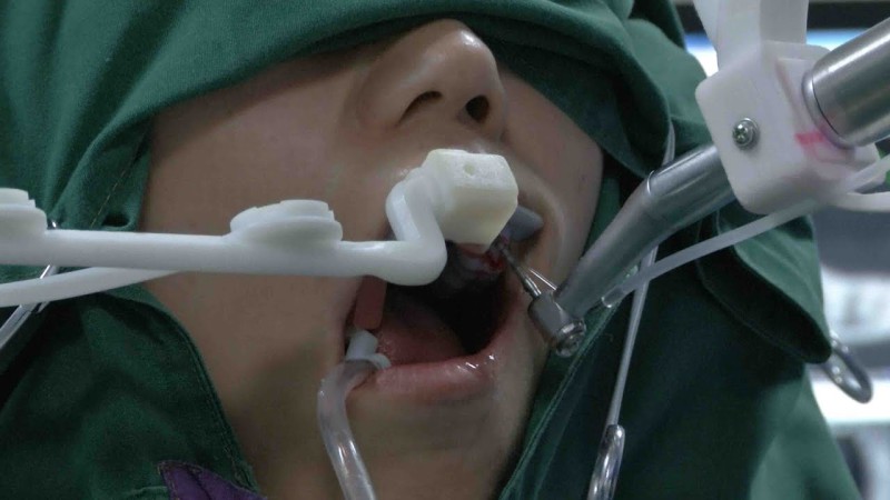 Фотография: В Китае робот-стоматолог впервые вставил зубы человеку №1 - BigPicture.ru