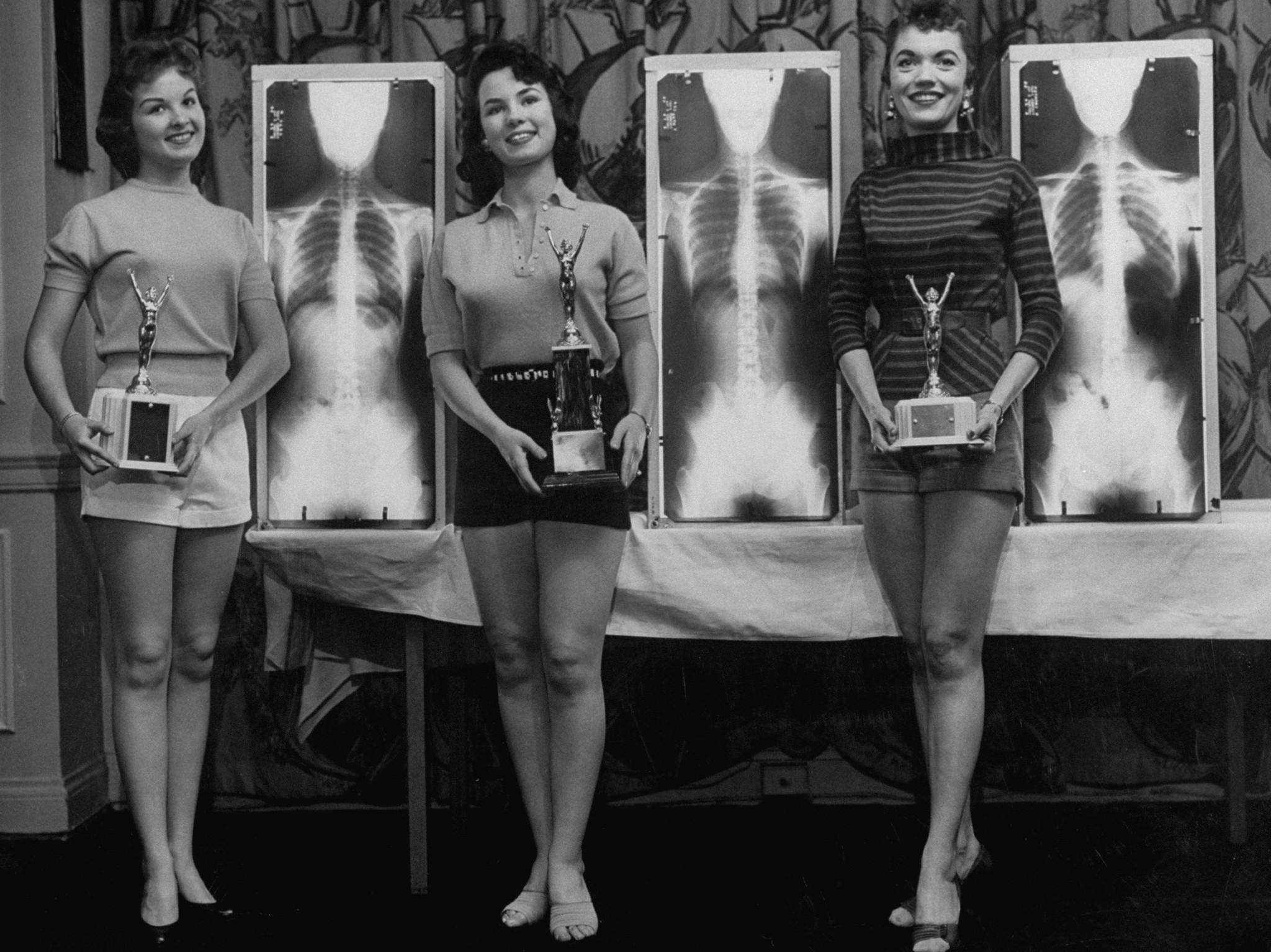 Фотография: Рентген, отвес и весы: как выбирали 