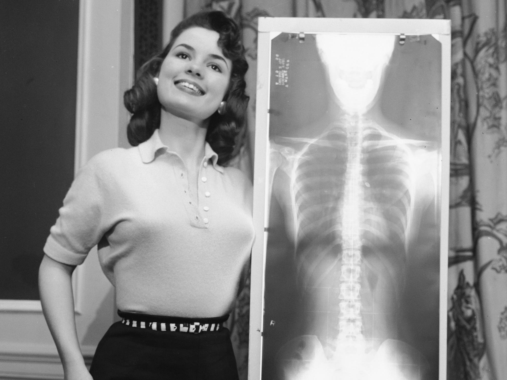 Фотография: Рентген, отвес и весы: как выбирали 