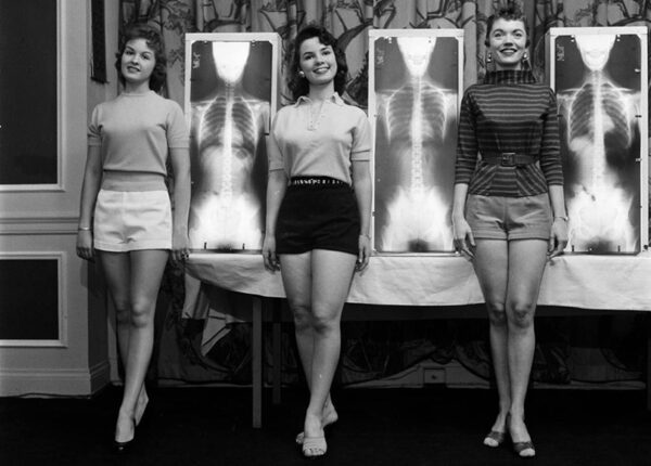 Рентген, отвес и весы: как выбирали «Мисс правильную осанку» в 50-е