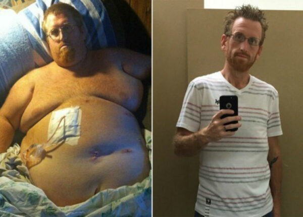 Американец думал, что лишний вес убьет его, записал предсмертное видео, а потом взял и похудел на 160 кг