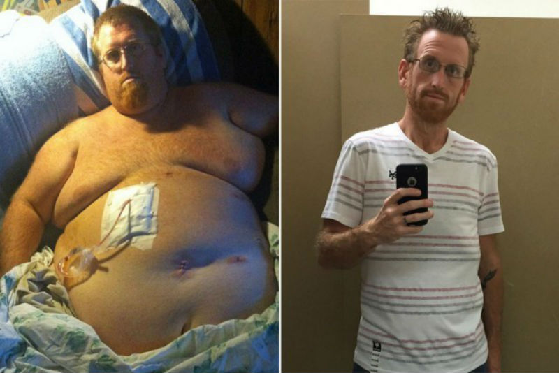 Фотография: Американец думал, что лишний вес убьет его, записал предсмертное видео, а потом взял и похудел на 160 кг №1 - BigPicture.ru