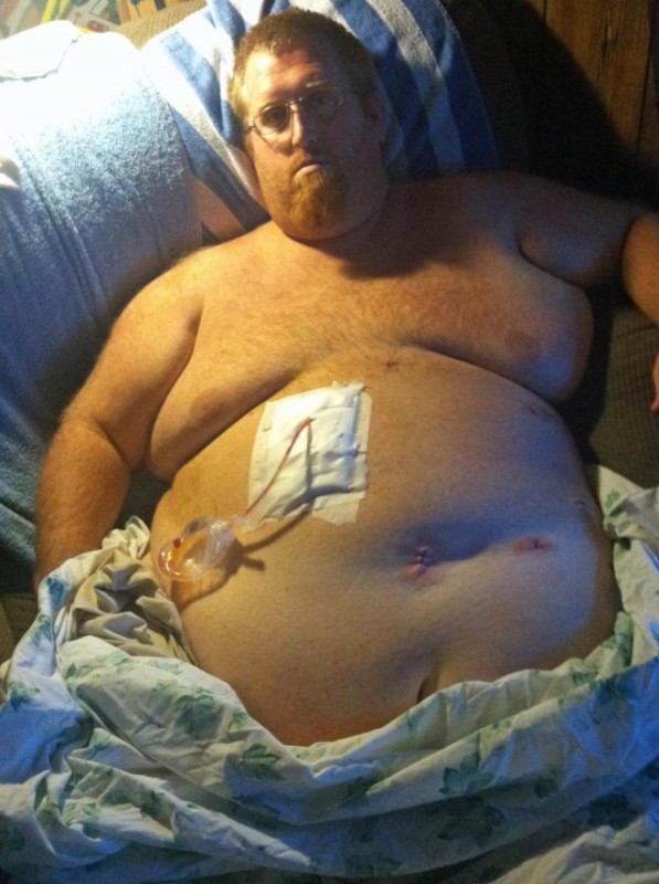 Фотография: Американец думал, что лишний вес убьет его, записал предсмертное видео, а потом взял и похудел на 160 кг №3 - BigPicture.ru
