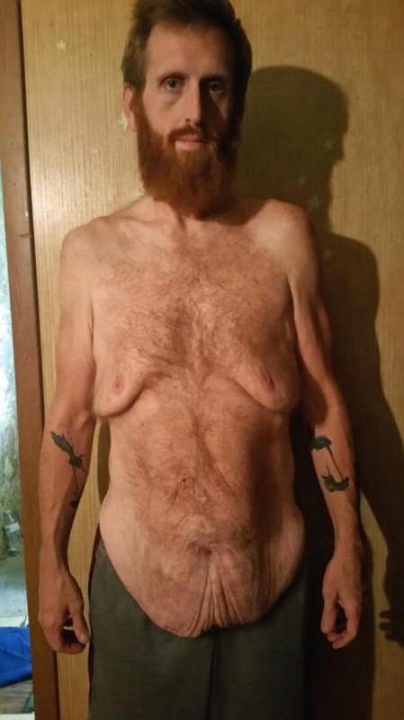 Фотография: Американец думал, что лишний вес убьет его, записал предсмертное видео, а потом взял и похудел на 160 кг №5 - BigPicture.ru