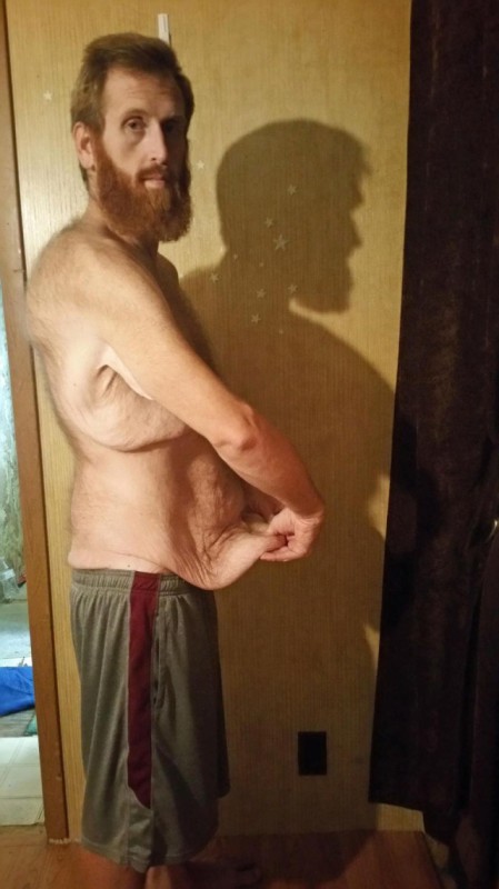 Фотография: Американец думал, что лишний вес убьет его, записал предсмертное видео, а потом взял и похудел на 160 кг №4 - BigPicture.ru