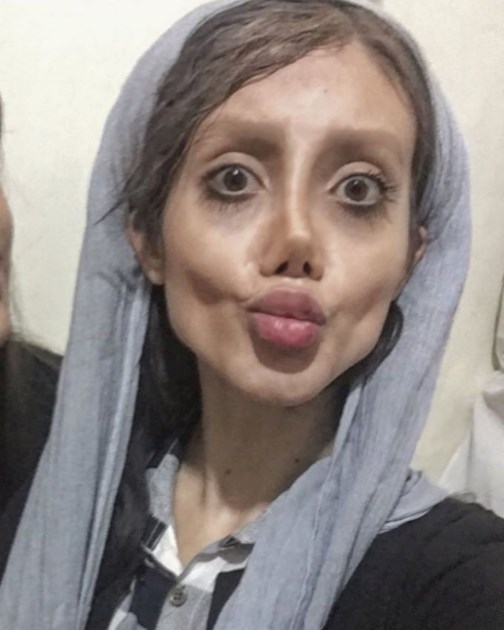 Фотография: Иранка сделала 50 операций ради сходства с Анджелиной Джоли и теперь похожа на зомби №10 - BigPicture.ru
