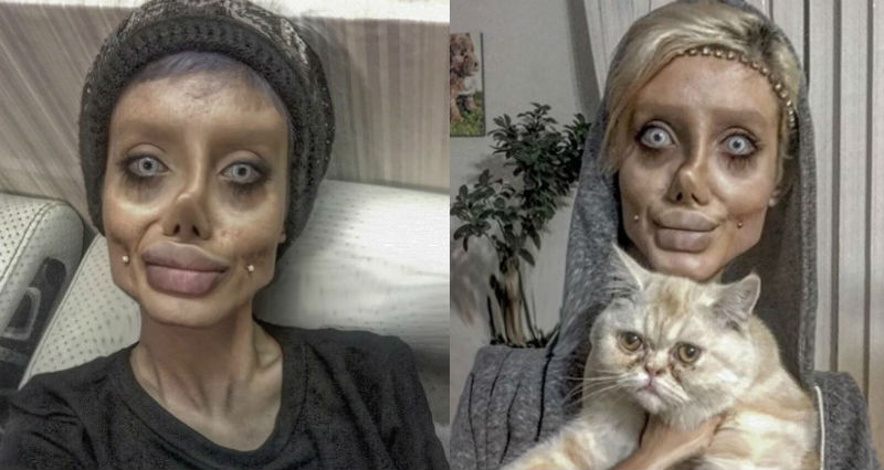 Фотография: Иранка сделала 50 операций ради сходства с Анджелиной Джоли и теперь похожа на зомби №1 - BigPicture.ru