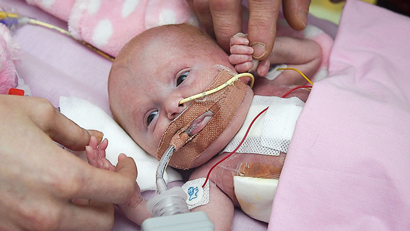 Фотография: Британские врачи спасли малышку, которая родилась с сердцем наружу №1 - BigPicture.ru