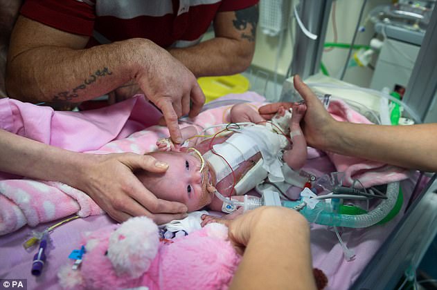 Фотография: Британские врачи спасли малышку, которая родилась с сердцем наружу №4 - BigPicture.ru