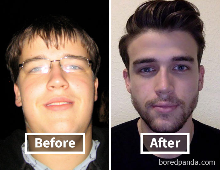 Фотография: 32 вдохновляющих примера того, как похудение преображает лицо №4 - BigPicture.ru