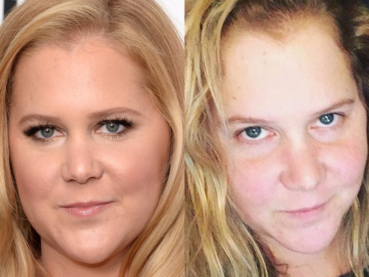 Эми шумер похудела фото до и после