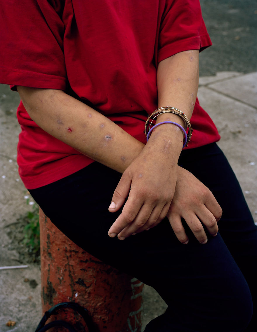 Фотография: Американская эпидемия наркомании в портретах Джеффри Стокбриджа №15 - BigPicture.ru