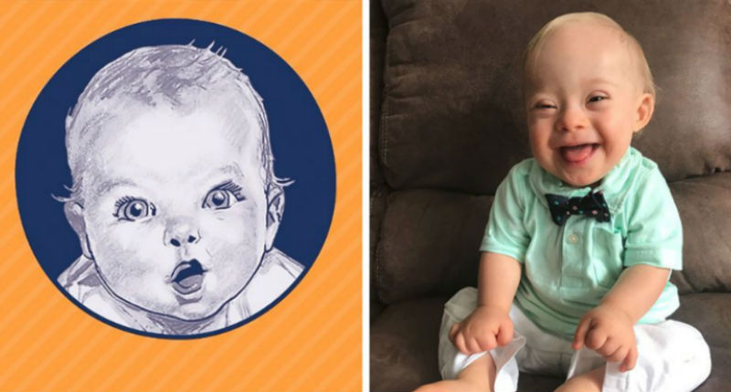 Фотография: Малыш с синдромом Дауна покорил Gerber своей улыбкой и стал лицом компании детского питания №1 - BigPicture.ru