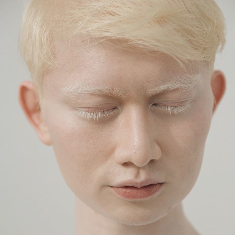 Фотография: Как выглядят альбиносы разных национальностей и рас №13 - BigPicture.ru