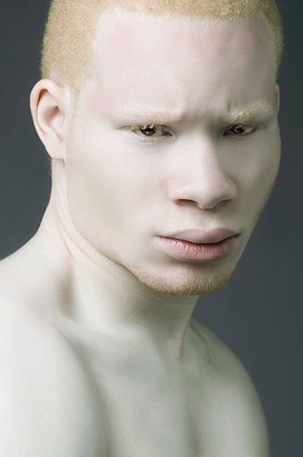 Фотография: Как выглядят альбиносы разных национальностей и рас №14 - BigPicture.ru