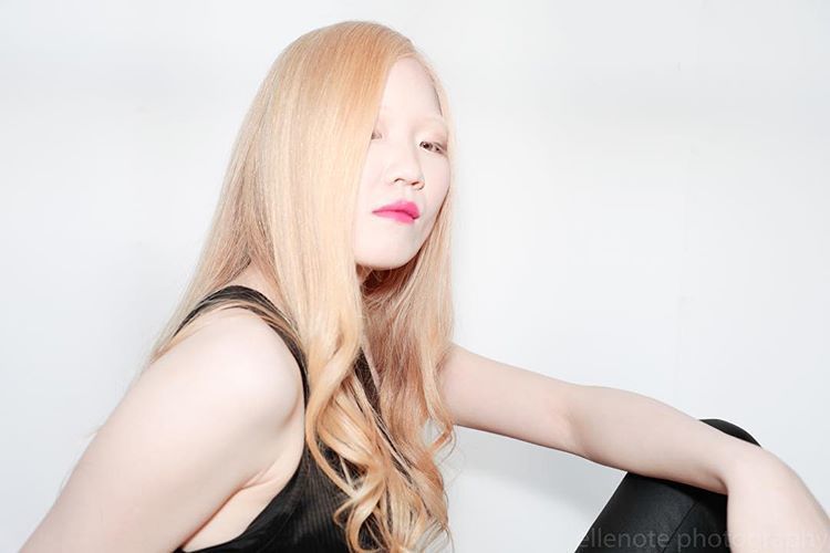 Фотография: Как выглядят альбиносы разных национальностей и рас №16 - BigPicture.ru