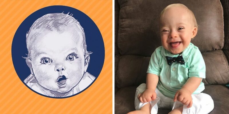 Фотография: Малыш с синдромом Дауна покорил Gerber своей улыбкой и стал лицом компании детского питания №4 - BigPicture.ru
