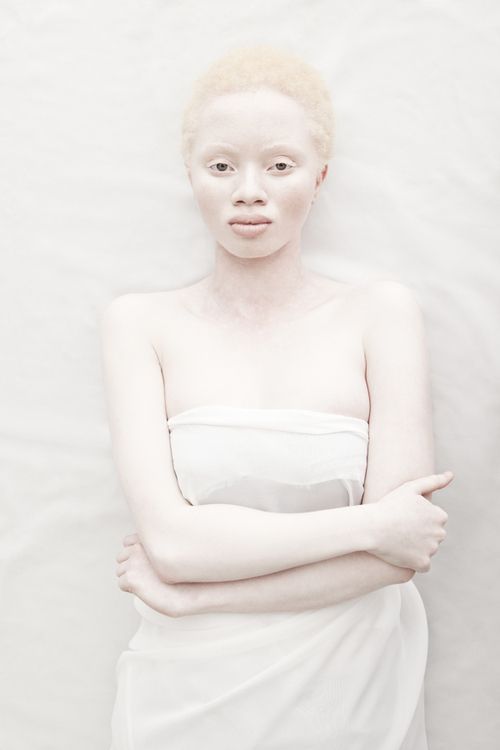 Фотография: Как выглядят альбиносы разных национальностей и рас №19 - BigPicture.ru