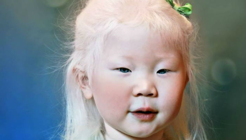 Фотография: Как выглядят альбиносы разных национальностей и рас №1 - BigPicture.ru