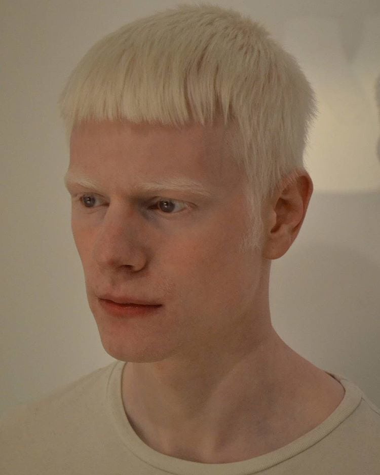 Фотография: Как выглядят альбиносы разных национальностей и рас №21 - BigPicture.ru