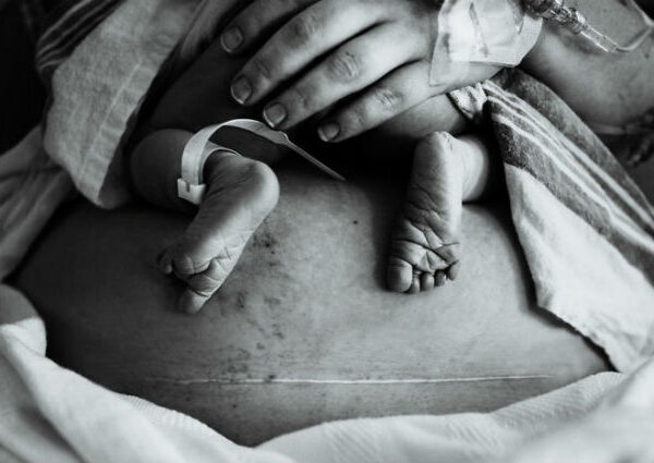 Агония и экстаз: 20 ошеломляющих кадров фотоконкурса о рождении ребенка Birth Becomes Her 2018