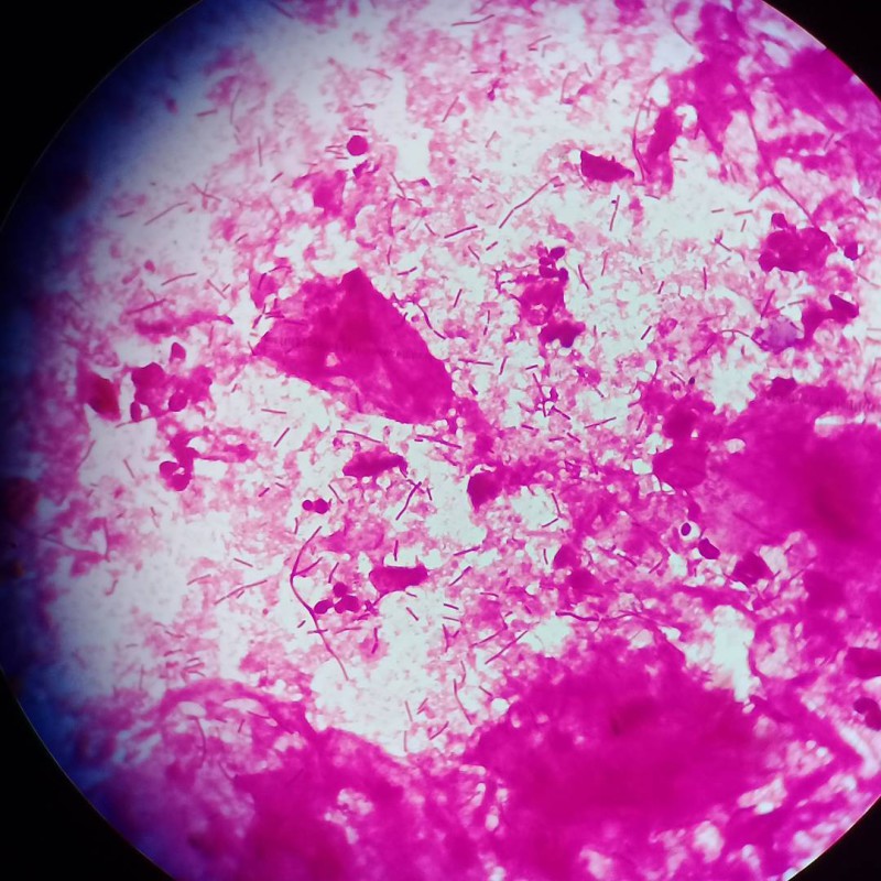 Фотография: Красота внутри: микробиолог из Уфы показывает в инстаграме вирусы и бактерии, которые живут в нас №4 - BigPicture.ru