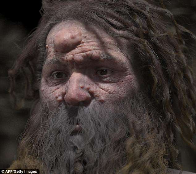 Фотография: Ученые воссоздали внешность кроманьонца, лицо которого покрыто опухолями №5 - BigPicture.ru