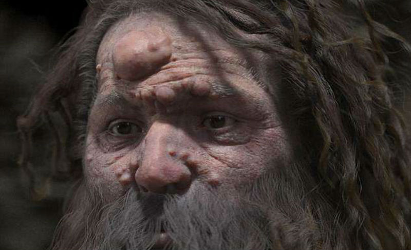 Фотография: Ученые воссоздали внешность кроманьонца, лицо которого покрыто опухолями №1 - BigPicture.ru
