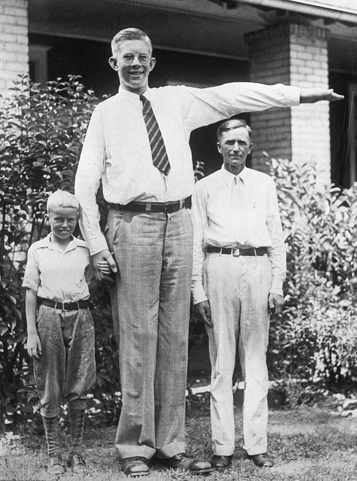 фото Роберт Уодлоу самый высокий человек в истории