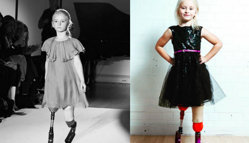 Фотография: Семилетняя девочка с ампутированными ногами строит карьеру в модельном бизнесе №1 - BigPicture.ru