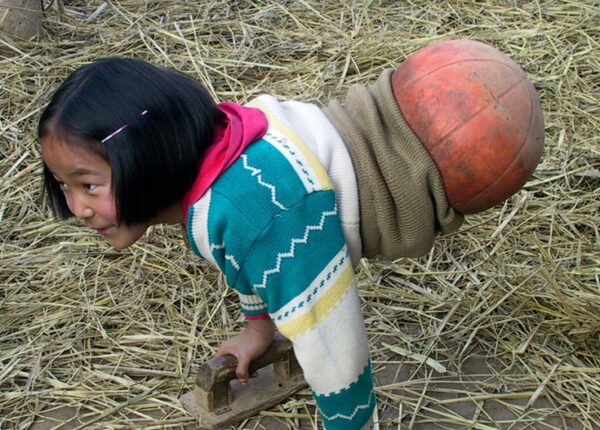 Национальная героиня Китая: девочка с баскетбольным мячом вместо ног стала известной спортсменкой