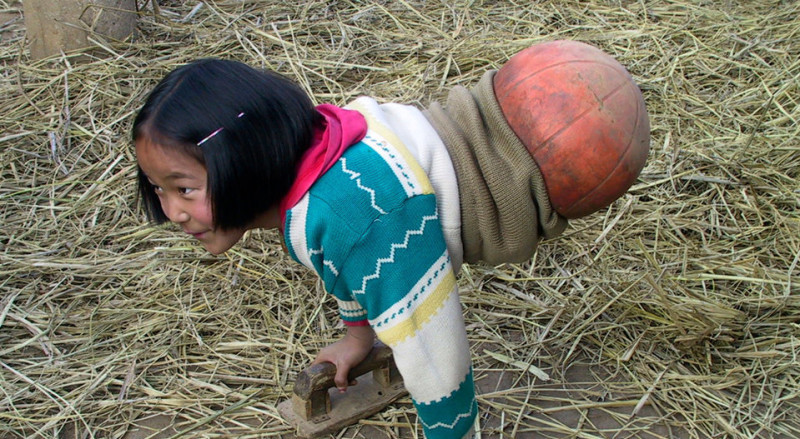 Фотография: Национальная героиня Китая: девочка с баскетбольным мячом вместо ног стала известной спортсменкой №1 - BigPicture.ru