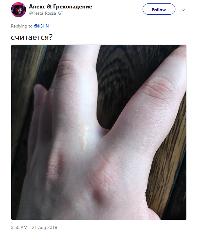 Фотография: Люди вдруг осознали, что у всех них есть шрам на указательном пальце №3 - BigPicture.ru
