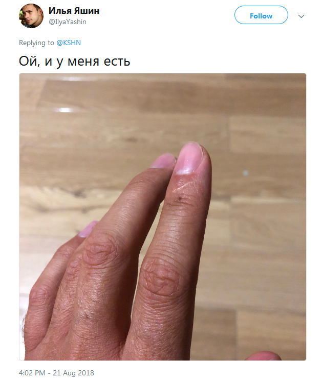 Фотография: Люди вдруг осознали, что у всех них есть шрам на указательном пальце №4 - BigPicture.ru