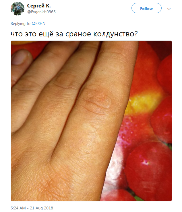 Фотография: Люди вдруг осознали, что у всех них есть шрам на указательном пальце №5 - BigPicture.ru