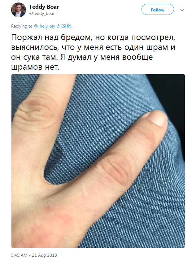 Фотография: Люди вдруг осознали, что у всех них есть шрам на указательном пальце №6 - BigPicture.ru