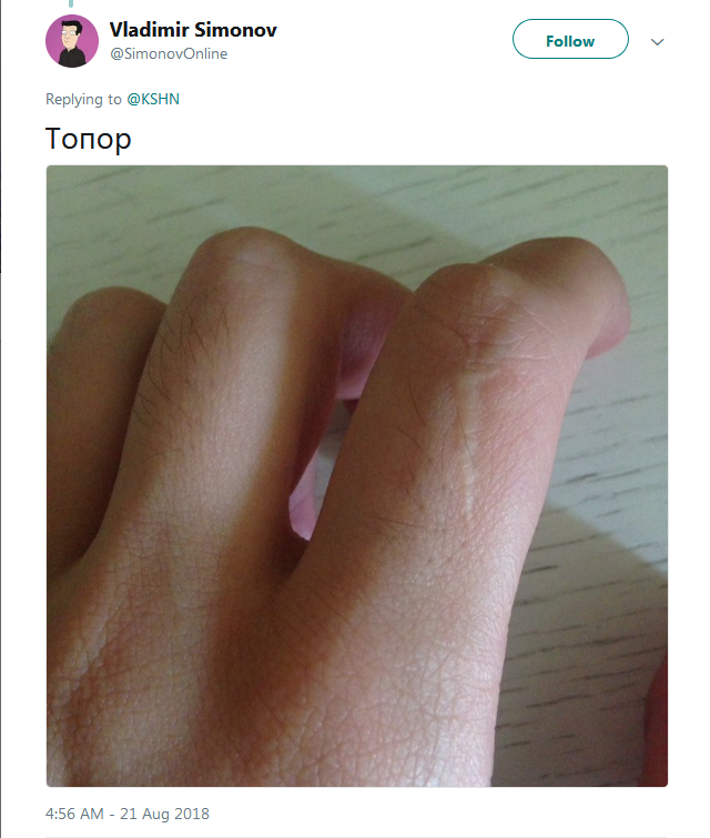 Фотография: Люди вдруг осознали, что у всех них есть шрам на указательном пальце №7 - BigPicture.ru