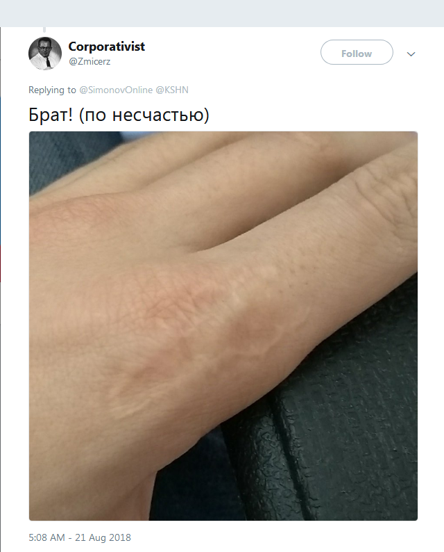 Фотография: Люди вдруг осознали, что у всех них есть шрам на указательном пальце №8 - BigPicture.ru