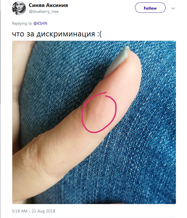 Фотография: Люди вдруг осознали, что у всех них есть шрам на указательном пальце №12 - BigPicture.ru