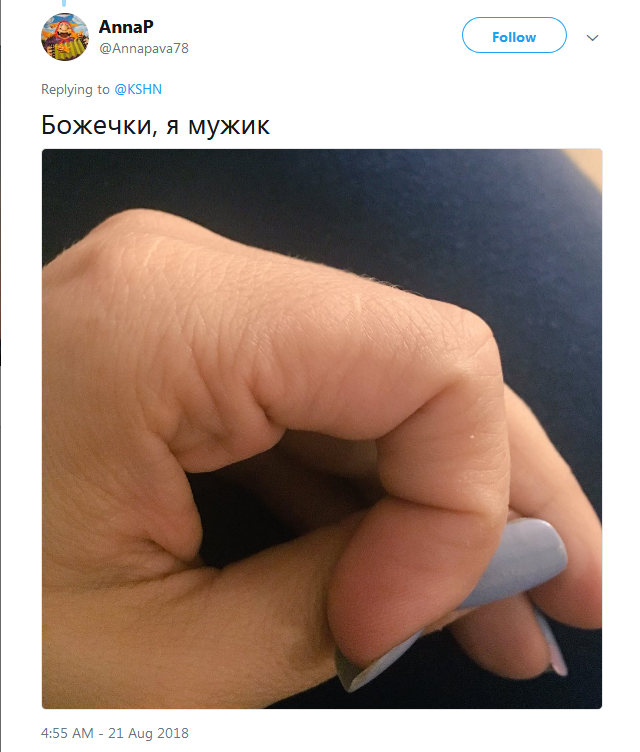 Фотография: Люди вдруг осознали, что у всех них есть шрам на указательном пальце №13 - BigPicture.ru